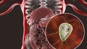 Jak rozpoznać obecność pasożytów w organizmie?