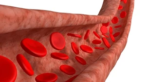 Produkty, które oczyszczą twoje naczynia krwionośne