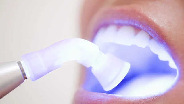 wybielanie zębów mity