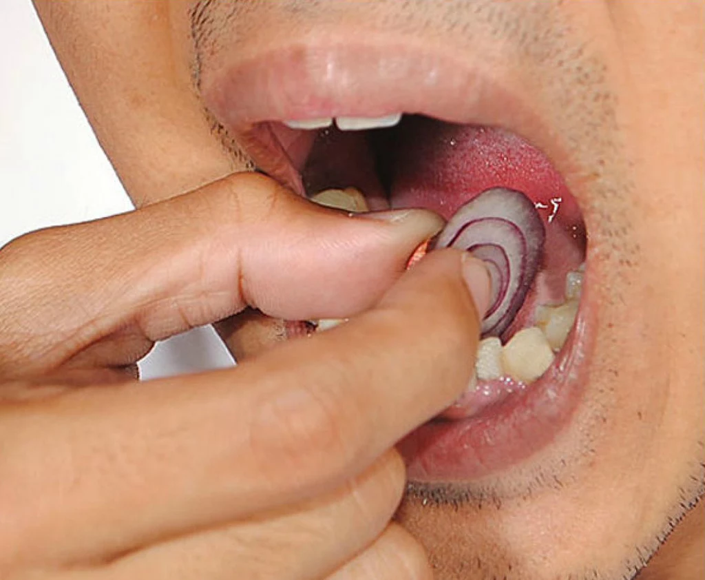cebula na ból zęba 1