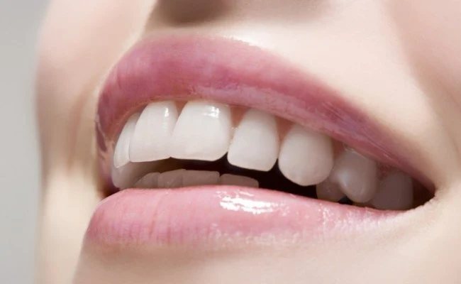 wybielanie zębów wybielanie zębów