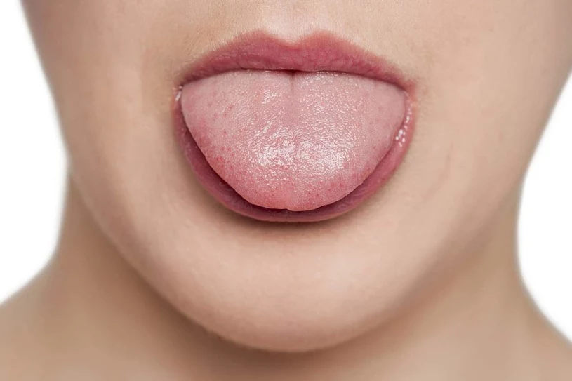 Czerwone usta i spuchnięty język