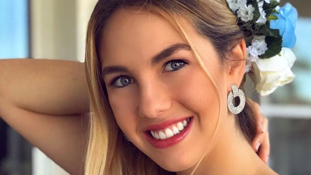 22-letnia Alina Akselrad to tegoroczna miss Argentyny, pochodząca z Cordoby. 

Chociaż na pierwszy rzut oka niewiele osób mogłoby się domyślić, że ta piękność miała kiedyś kompleksy, to okazuje się, że właśnie taka jest prawda. 