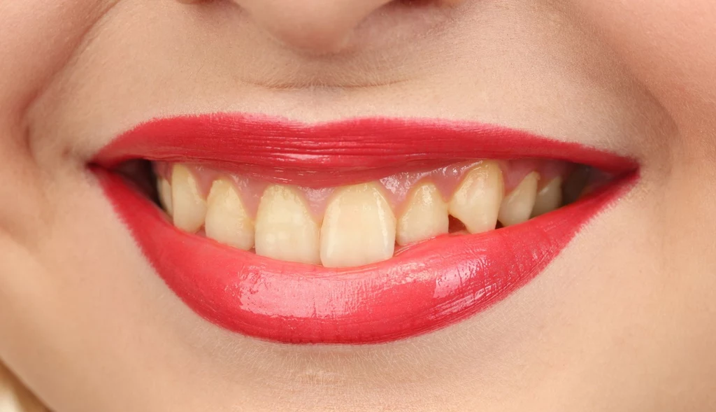 Od lat zmagasz się z pożółkłymi zębami? Zwróć uwagę na swoje codzienne nawyki!