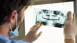 Do dentystów i ortopedów zgłasza się coraz więcej osób z bólem zębów i szczęki