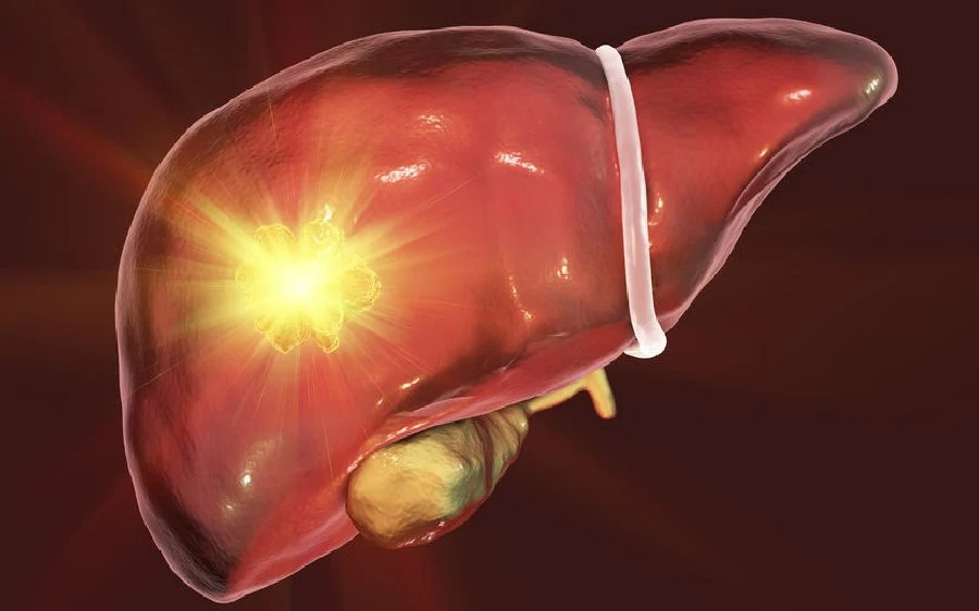Objawy chorób wątroby można pomylić z innymi przypadłościami