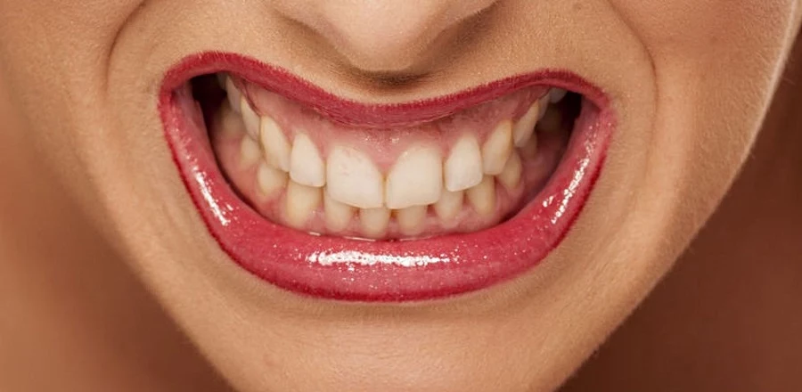 Zęby są wrażliwe na działanie leków
