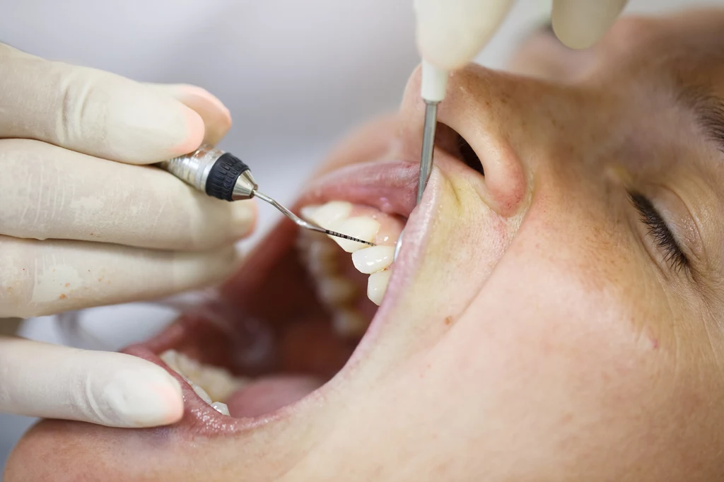 Rekomendacja leczenie zależy od stomatologa
