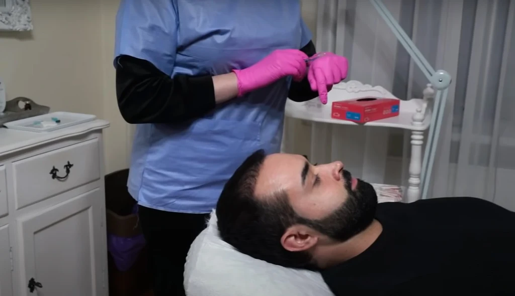 Paweł Svinarski z "Dla pieniędzy" postanowił powiększyć usta Paweł Svinarski z "Dla pieniędzy" postanowił powiększyć usta