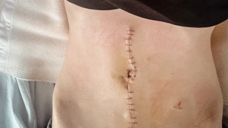 Mówili, że boli przez stres. Lata błędnych diagnoz 