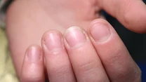 Manicure żelowy: Czy naprawdę niszczy paznokcie?  

Ekspertki na co dzień zajmujące się pielęgnacją paznokci podkreślają, że prawidłowo wykonany, i co najważniejsze, właściwie zdjęty manicure żelowy nie niszczy paznokci. Dlatego tak ważne jest wybranie odpowiedniego salonu, który profesjonalnie zaopiekuje się naszymi paznokciami. Oczywiście może zdarzyć się, że po manicure nasza płytka będzie nieco osłabiona. Nie jest to jednak trwała zmiana i zwykle po kilkunastu dniach nasze paznokcie wrócą do formy. 