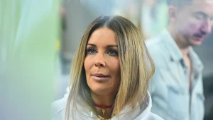 Siniaki na twarzy? To efekt "beauty day"