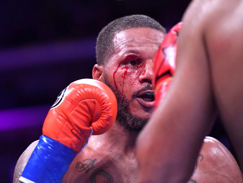 Anthony Dirrell