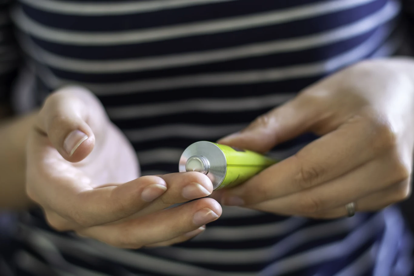 Maść z arniki świetnie poradzi sobie z pajączkami na nogach