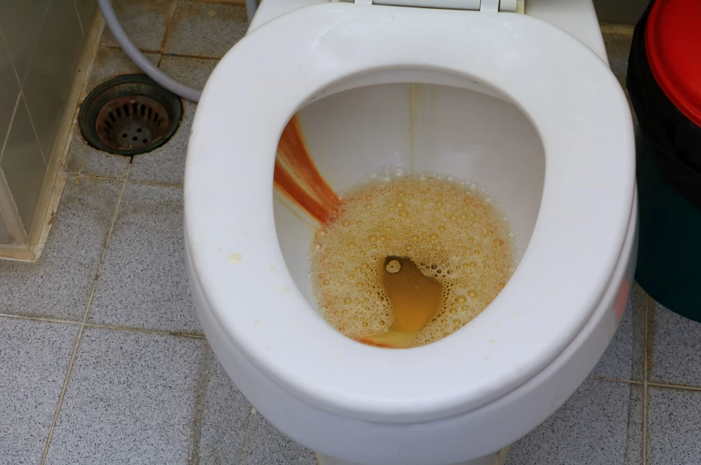 Rozgrzany ocet zwalczy kamień w toalecie Uporczywy kamień spędza sen z powiek niejednej pani domu, babcie wiedziały jak walczyć z nim skutecznie i naturalnymi sposobami. Podgrzej ocet, wlej go do muszli i pozostaw na ok. godzinę. Raz na tydzień możesz również zapobiegawczo przelewać muszlę ciepłym roztworem (jedna łyżka octu na litr wody), kamień nie będzie się tak szybko osadzał! 