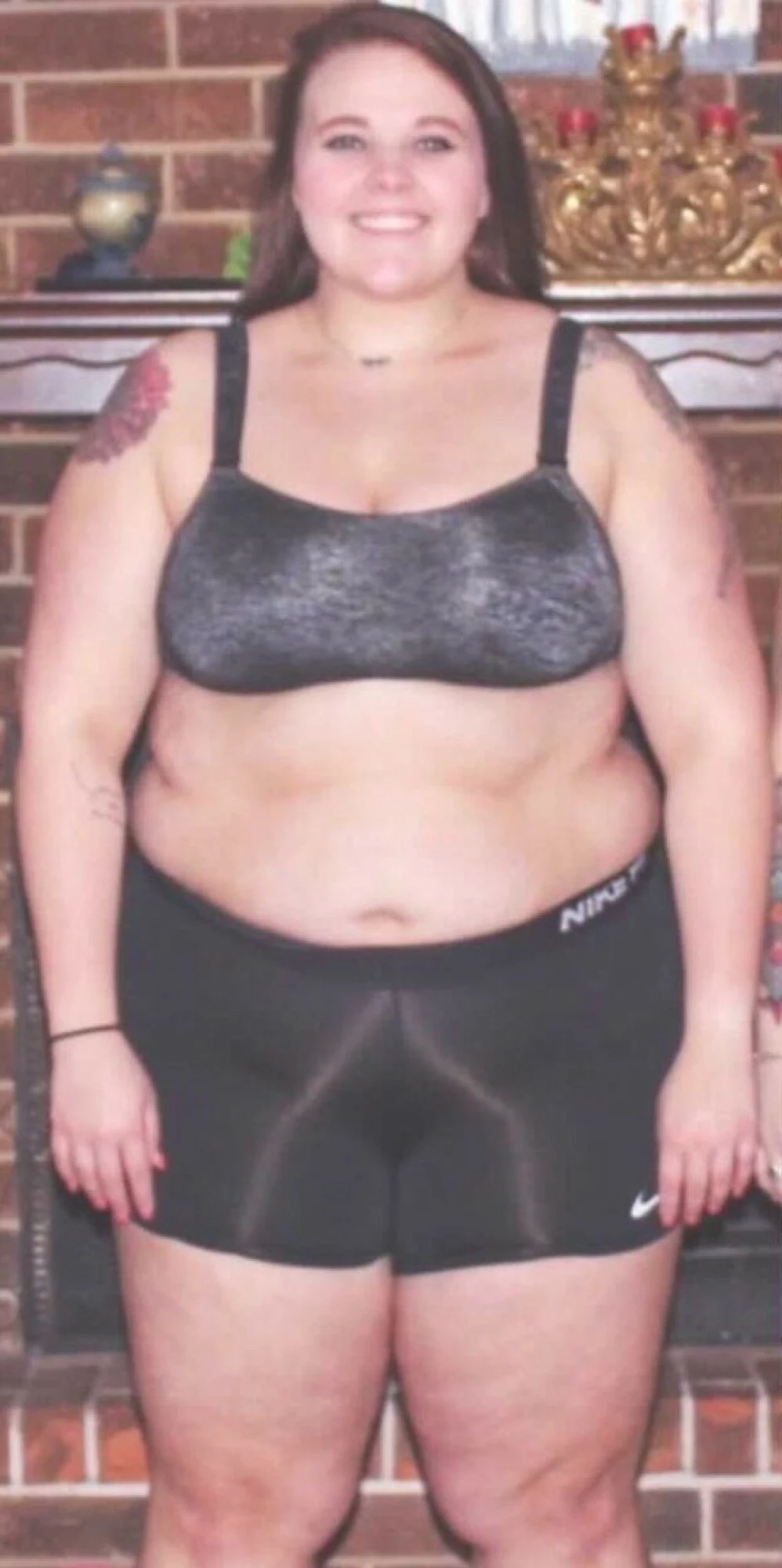 Efekt? Prawie 140 kg, które poważnie zagrażały jej zdrowiu. Amerykanka była również w coraz gorszym stanie psychicznym. Z powodu nadwagi wstydziła się wychodzić z domu, bo obawiała się oceny. Zamknięta w czterech ścianach zupełnie straciła kontrolę nad swoim życiem. Wreszcie nastąpił jednak przełom, bo w 2017 roku zrozumiała prostą zależność: im więcej waży, tym gorzej się czuje. Po konsultacji ze specjalistami zdecydowała się na operacyjne zmniejszenie żołądka aż o 80 procent. 