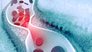 Eksperymentalna metoda do redukcji cholesterolu o 57 procent