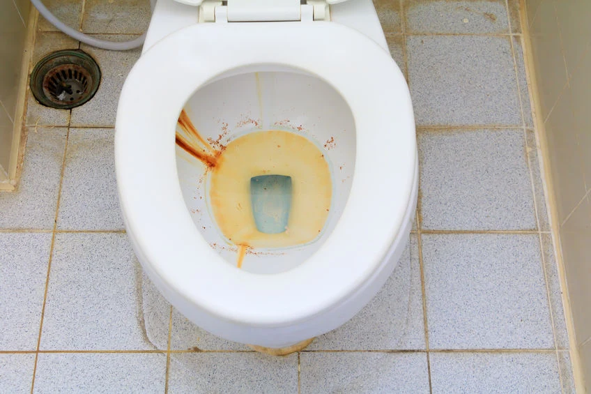 Rdzy z toalety z łatwością pozbędziesz się za pomocą domowych metod Rdzy z toalety z łatwością pozbędziesz się za pomocą domowych metod