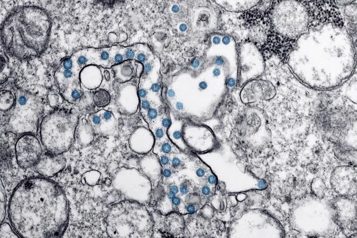 Wirus SARS-CoV-2 pod mikroskopem elektronowym