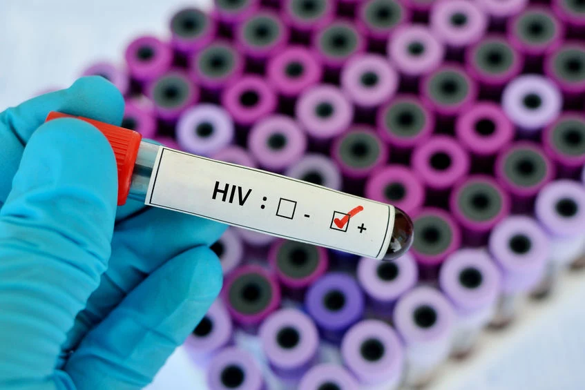 Aids to zespół nabytego upośledzenia odporności