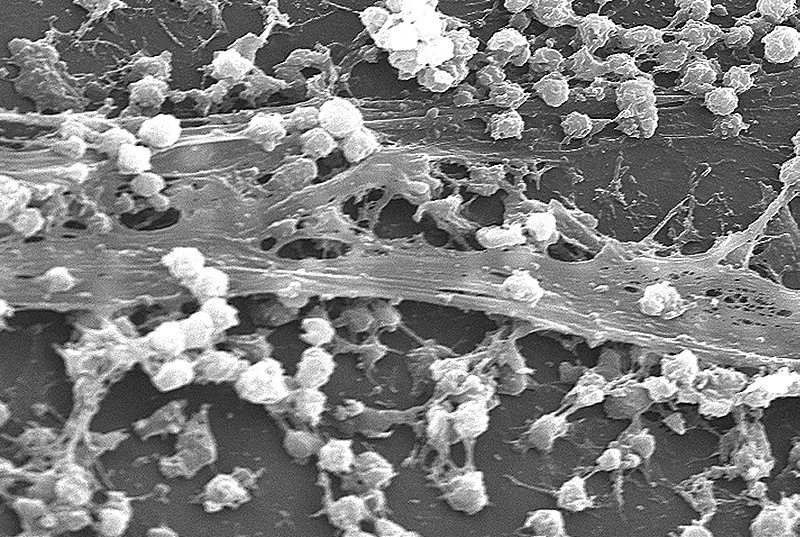 Biofilm wytworzony na kateterze przez gronkowca złocistego.