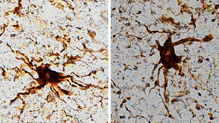 Tak wyglądają komórki glejowe, które rosną w tkankach mózgowych po śmierci