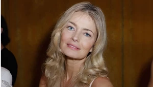  Paulina Porizkova pokazała twarz po zabiegu 