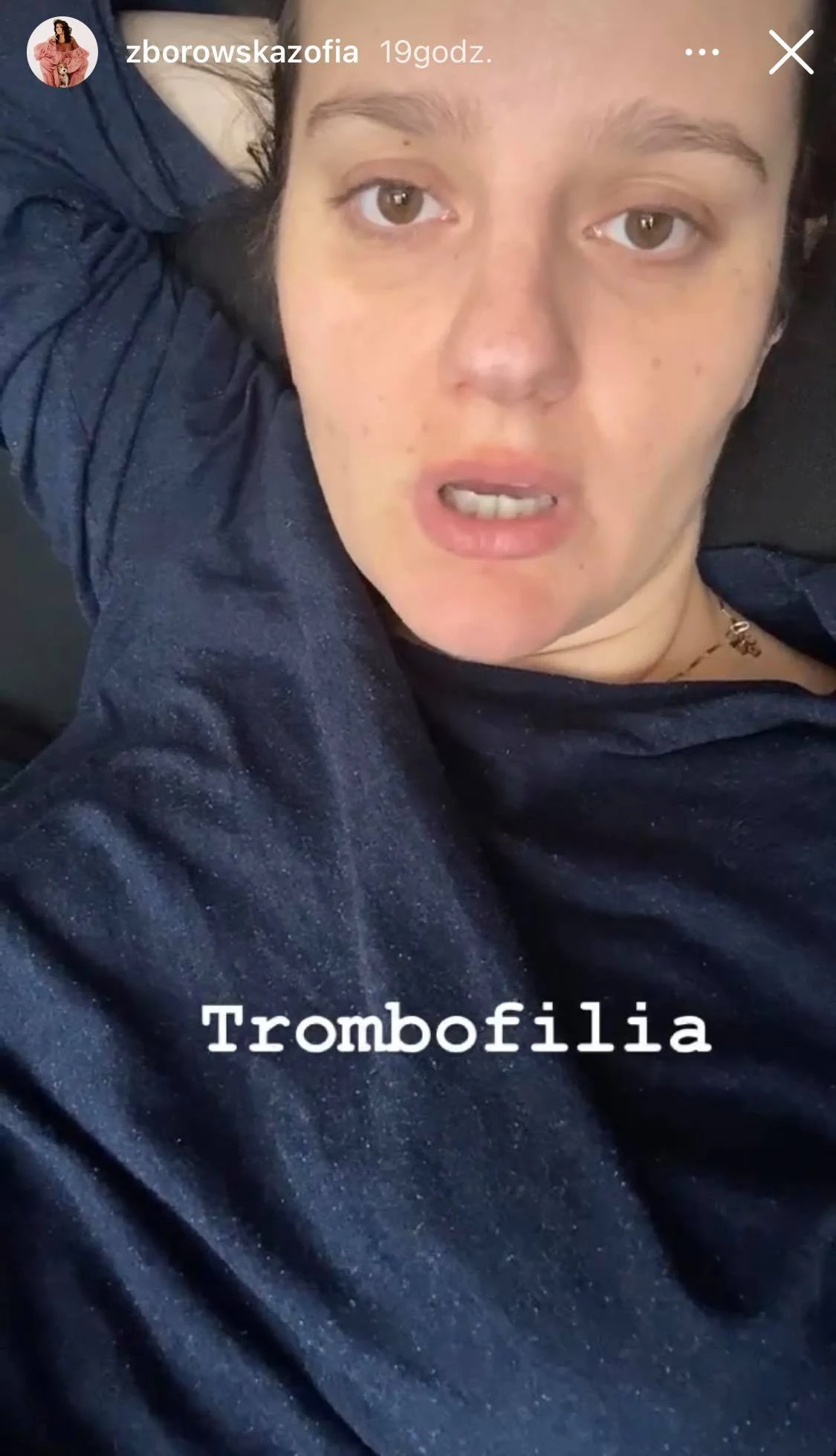 Zofia Zborowska opowiedziała o swojej chorobie Zofia Zborowska opowiedziała o swojej chorobie