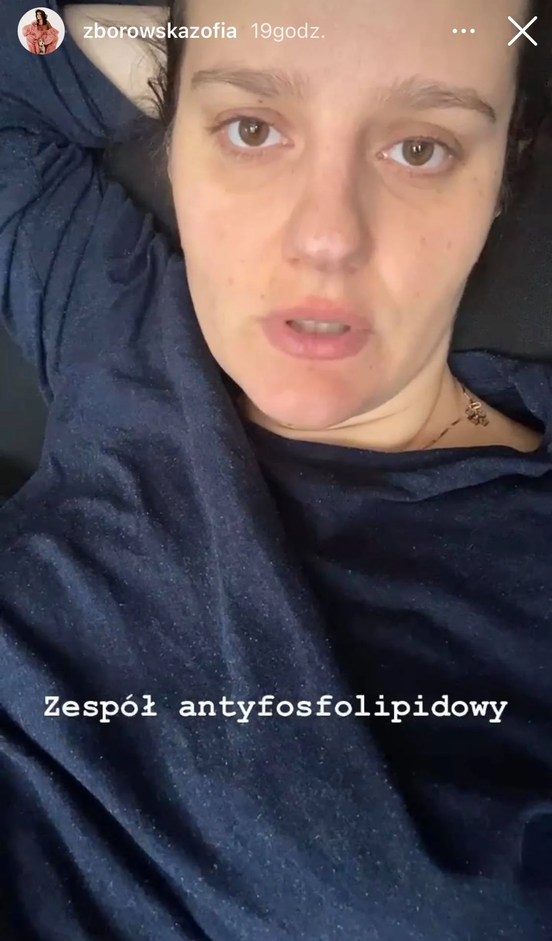 Aktorka zwraca uwagę na ważny problem Aktorka zwraca uwagę na ważny problem