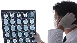 Lobotomię przeprowadzano w czasach, kiedy nie wiedziano, że jej skutków nie można odwrócić 