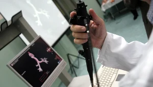 Bronchoskopia pomaga wykryć wiele chorób we wczesnym stadium 