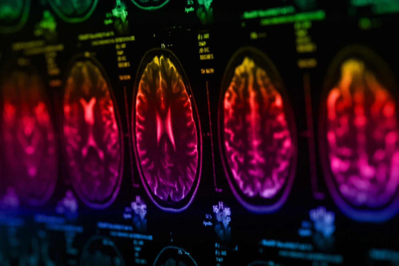 Las ma na nas zbawienny wpływ: redukuje poziom stresu, napięcia i zmęczenie. Na mózg może odetchnąć