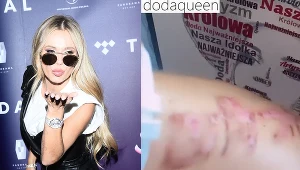 Doda pokazała proces usuwania tatuażu na swoim instastory 