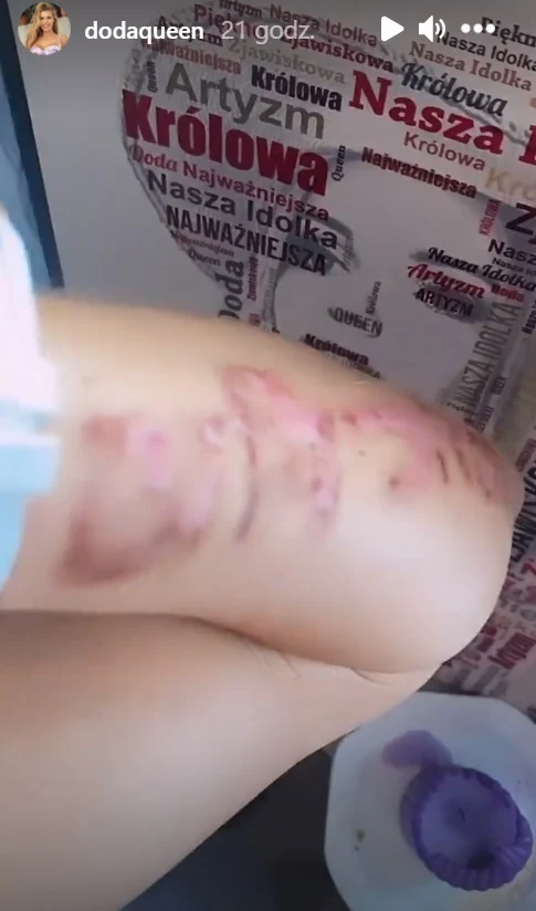 Screenshot z relacji @dodaqueen