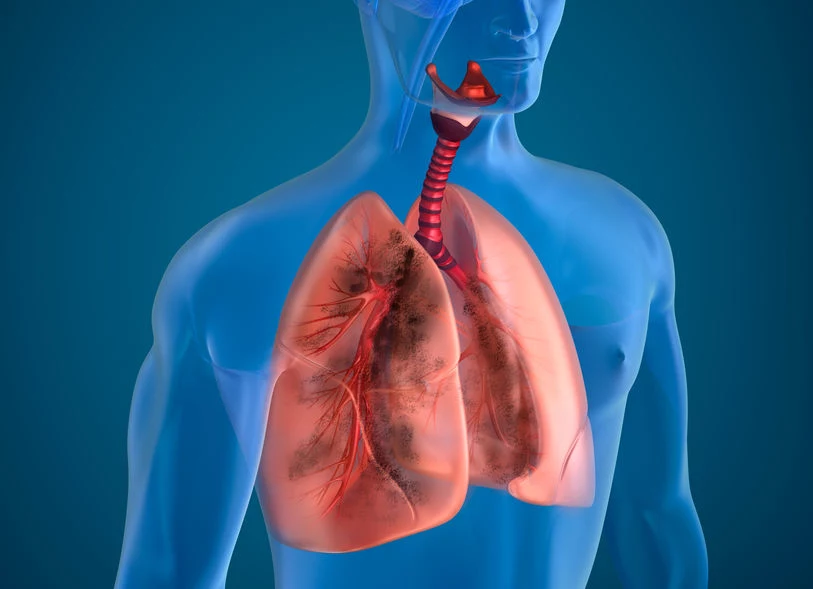 Formaldehyd wywołuje obrzęk płuc i zaburza ich pracę