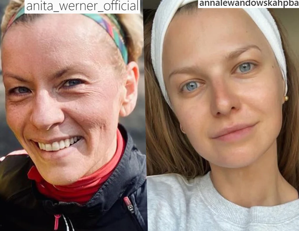 Zdjęcia z Insgarama @annalewandowskahpba i @anita_werner_official