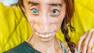 "Ta najbrzydsza". Hejterzy nie złamali Lizzie Velásquez