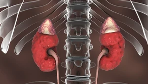 Odkryto enzym kluczowy w leczeniu przewlekłej choroby nerek
