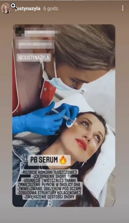 Justyna Żyła ostrzykuje się w gabinecie, fot. https://www.instagram.com/justynazyla/?hl=pl