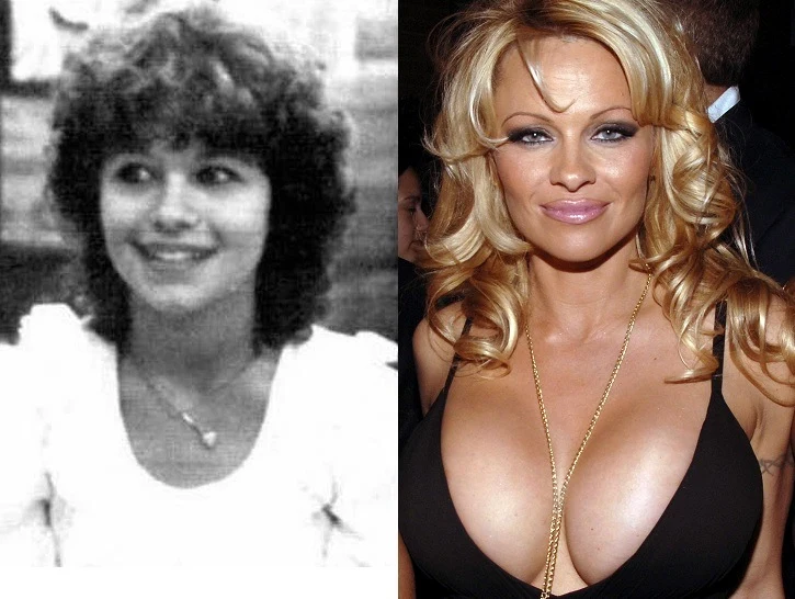 Pamela Anderson na początku swojej kariery (po lewej) i po ekstremalnej metamorfozie (po prawej)