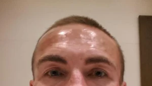 Przemysław Kossakowski powiększył sobie usta