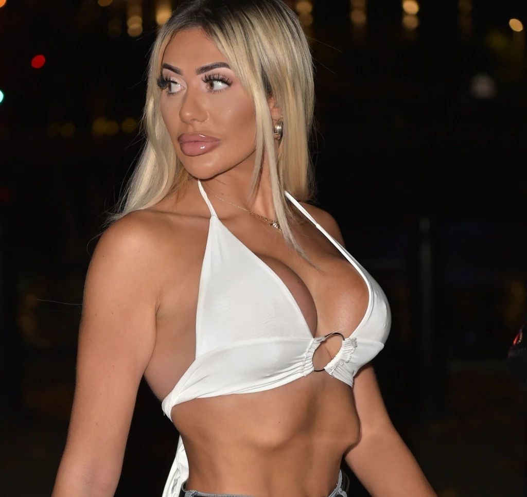 Chloe Ferry przesadziła ze sztuczną opalenizną