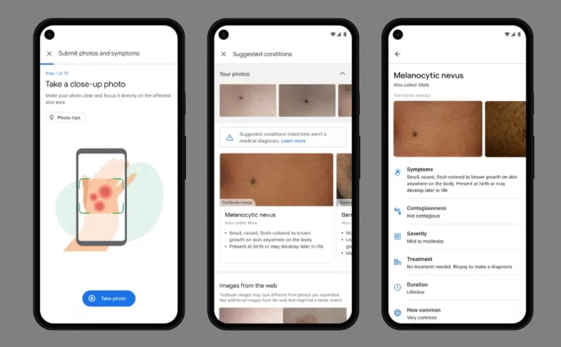 Google Derm Assist - po wykonaniu zdjęcia - pomoże nam zidentyfikować, co mamy na skórze