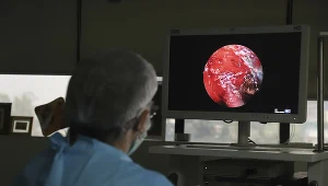 Czarny grzyb u pacjentów z COVID-19