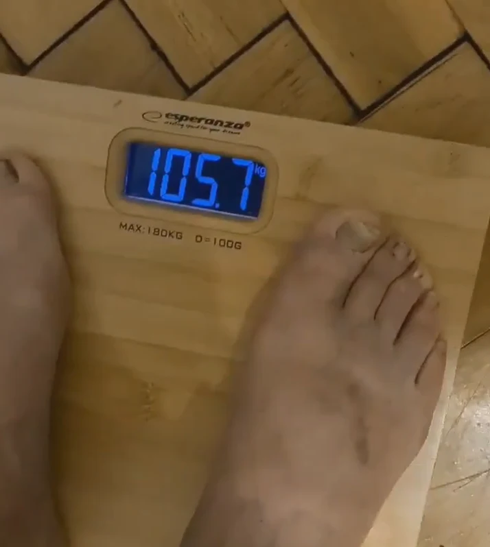 Internauci zaniepokojeni wyglądem stóp Korwin-Mikkego