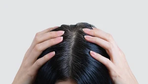 Silny stres to jedna z przyczyn siwienia w młodym wieku