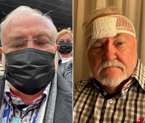 Andrzej Kosmala opublikował zdjęcie po wypadku, fot. andrzejkosmala/Facebook Andrzej Kosmala opublikował zdjęcie po wypadku, fot. andrzejkosmala/Facebook