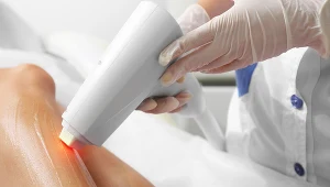 Planujesz depilację laserową? Musisz przestrzegać kilku ważnych zasad