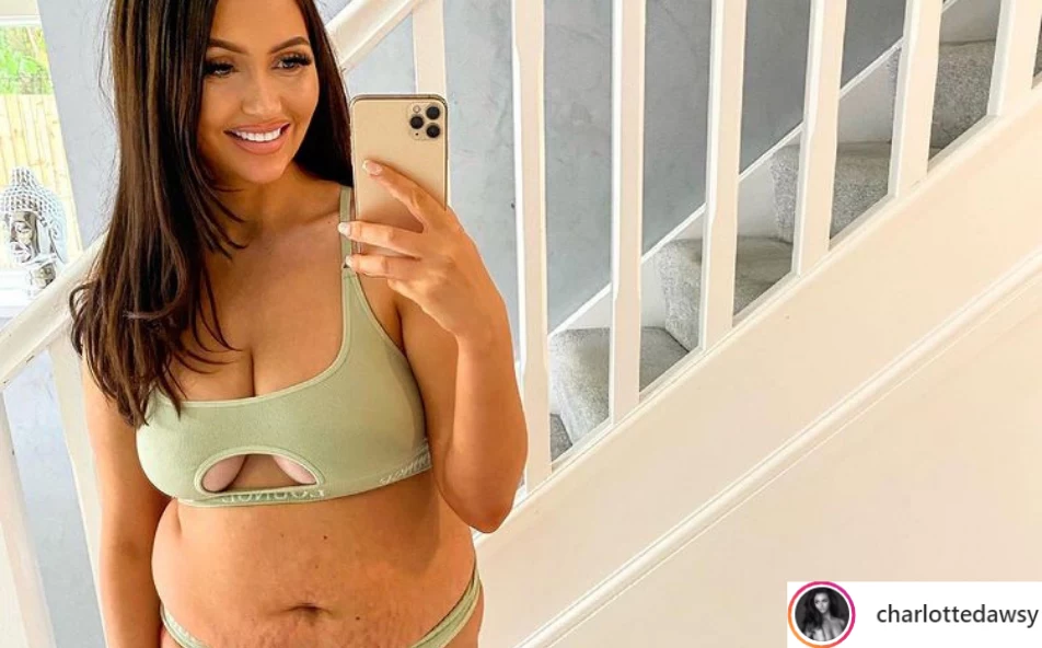 Charlotte Dawson z dumą pokazuje ciało po ciąży w mediach społecznościowych