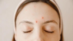 Różyczka jest niebezpieczna zwłaszcza u kobiet w ciąży